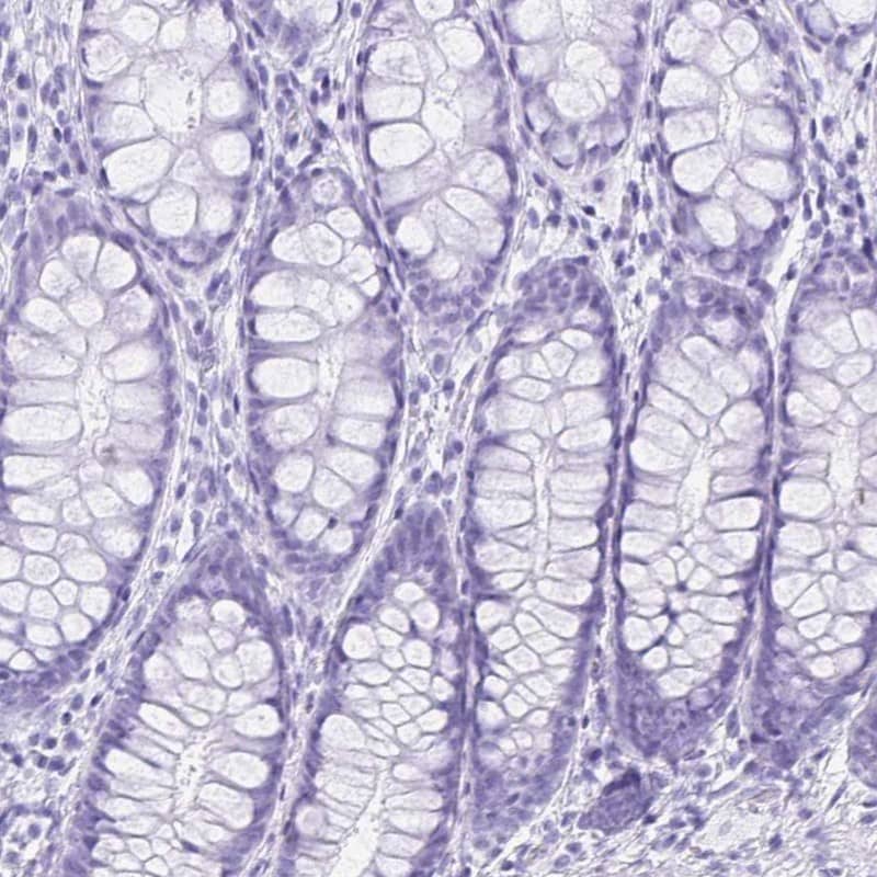 ERP27 Antibody - BSA Free Immunohistochemistry-Paraffin: ERP27 Antibody [NBP1-88393]