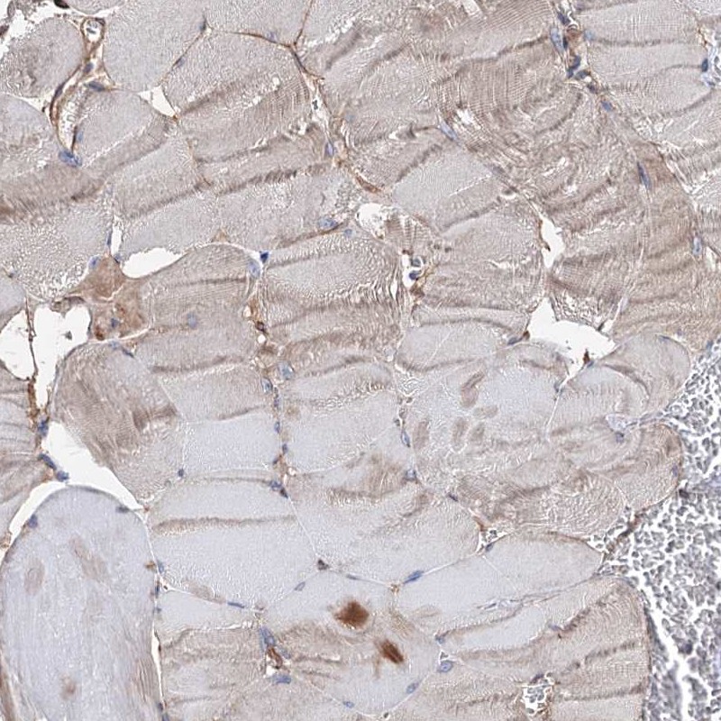 ERP29 Antibody - BSA Free Immunohistochemistry-Paraffin: ERP29 Antibody - BSA Free [NBP1-88395]