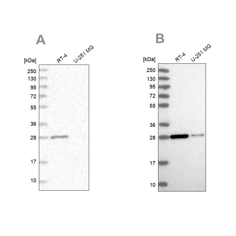 ERP29 Antibody - BSA Free Western Blot: ERP29 Antibody - BSA Free [NBP1-88395]