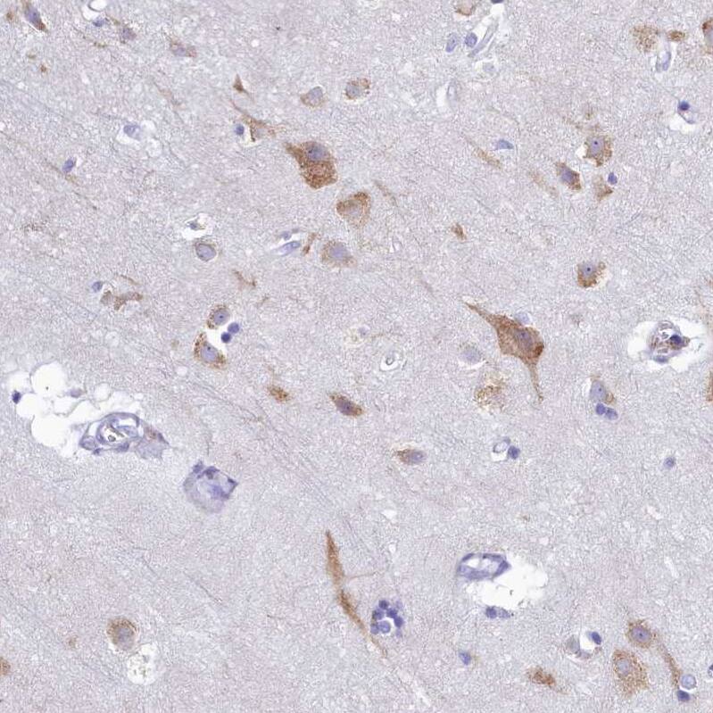 SKA3 Antibody - BSA Free Immunohistochemistry-Paraffin: SKA3 Antibody - BSA Free [NBP1-88398]