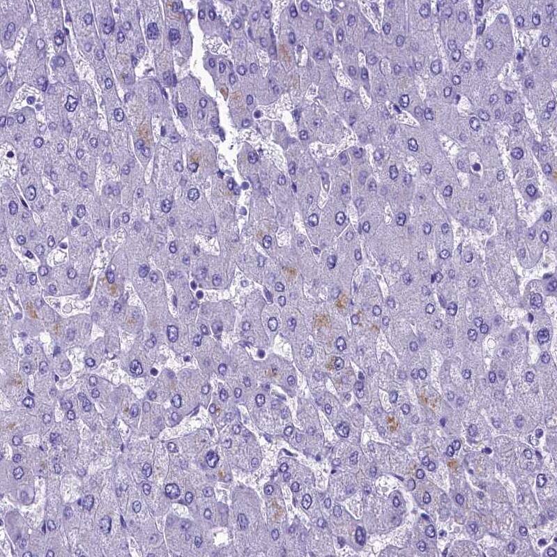 SKA3 Antibody - BSA Free Immunohistochemistry-Paraffin: SKA3 Antibody - BSA Free [NBP1-88398]