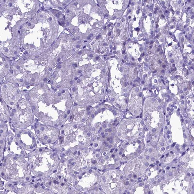 SKA3 Antibody - BSA Free Immunohistochemistry-Paraffin: SKA3 Antibody - BSA Free [NBP1-88398]