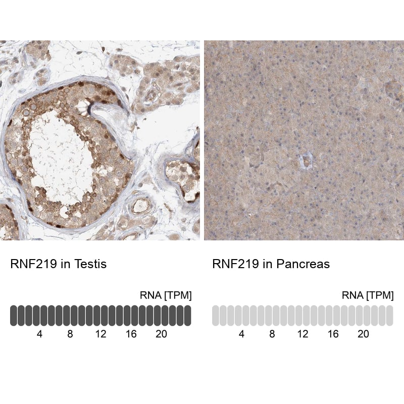 RNF219 Antibody - BSA Free Immunohistochemistry-Paraffin: RNF219 Antibody [NBP1-88401]