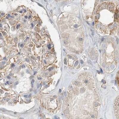 RNF219 Antibody - BSA Free Immunohistochemistry-Paraffin: RNF219 Antibody [NBP1-88401]