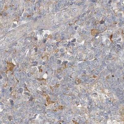 RNF219 Antibody - BSA Free Immunohistochemistry-Paraffin: RNF219 Antibody [NBP1-88401]