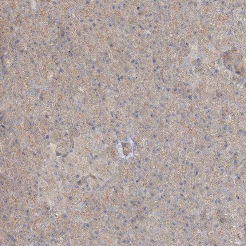 RNF219 Antibody - BSA Free Immunohistochemistry-Paraffin: RNF219 Antibody [NBP1-88401]