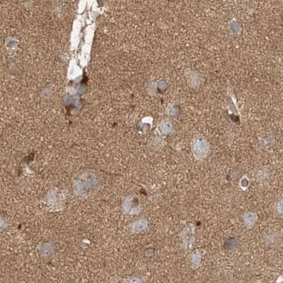 RNF219 Antibody - BSA Free Immunohistochemistry-Paraffin: RNF219 Antibody [NBP1-88401]