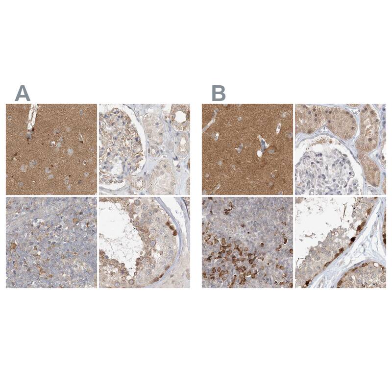 RNF219 Antibody - BSA Free Immunohistochemistry-Paraffin: RNF219 Antibody [NBP1-88401]