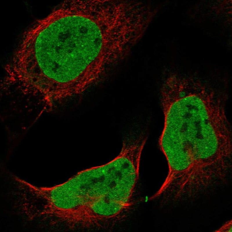 ZNF828 Antibody - BSA Free Immunocytochemistry/ Immunofluorescence: ZNF828 Antibody [NBP1-88402]
