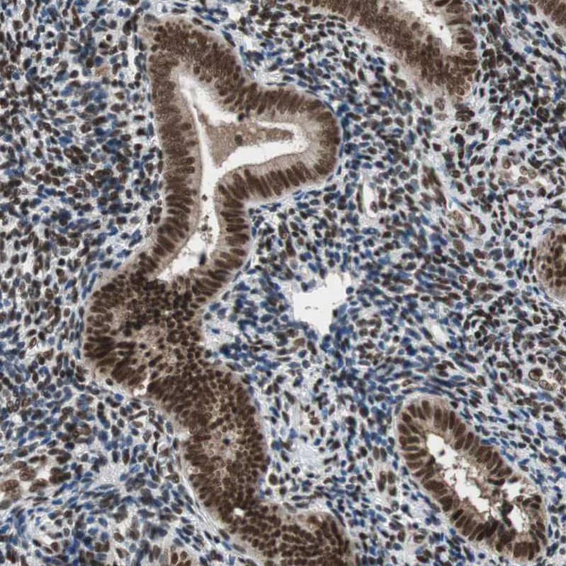 ZNF828 Antibody - BSA Free Immunohistochemistry-Paraffin: ZNF828 Antibody - BSA Free [NBP1-88402]