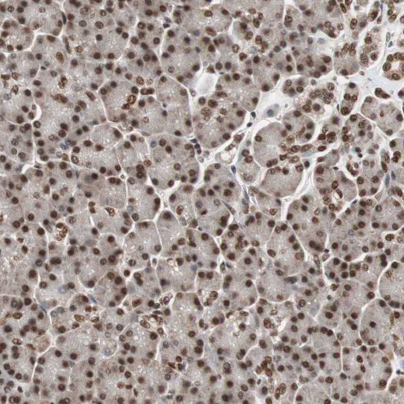 ZNF828 Antibody - BSA Free Immunohistochemistry-Paraffin: ZNF828 Antibody - BSA Free [NBP1-88402]