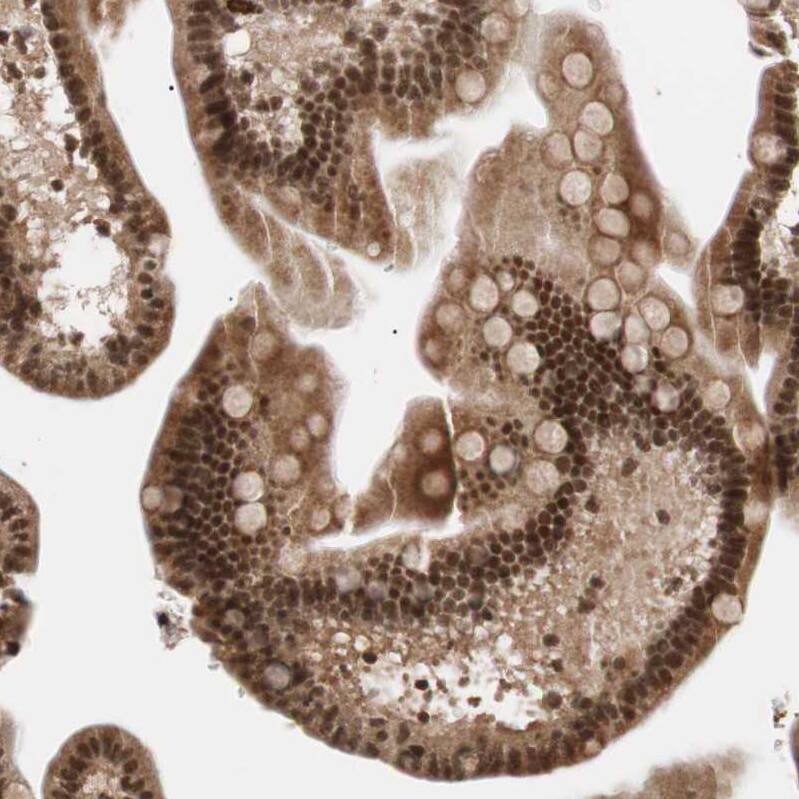 ZNF828 Antibody - BSA Free Immunohistochemistry-Paraffin: ZNF828 Antibody - BSA Free [NBP1-88402]