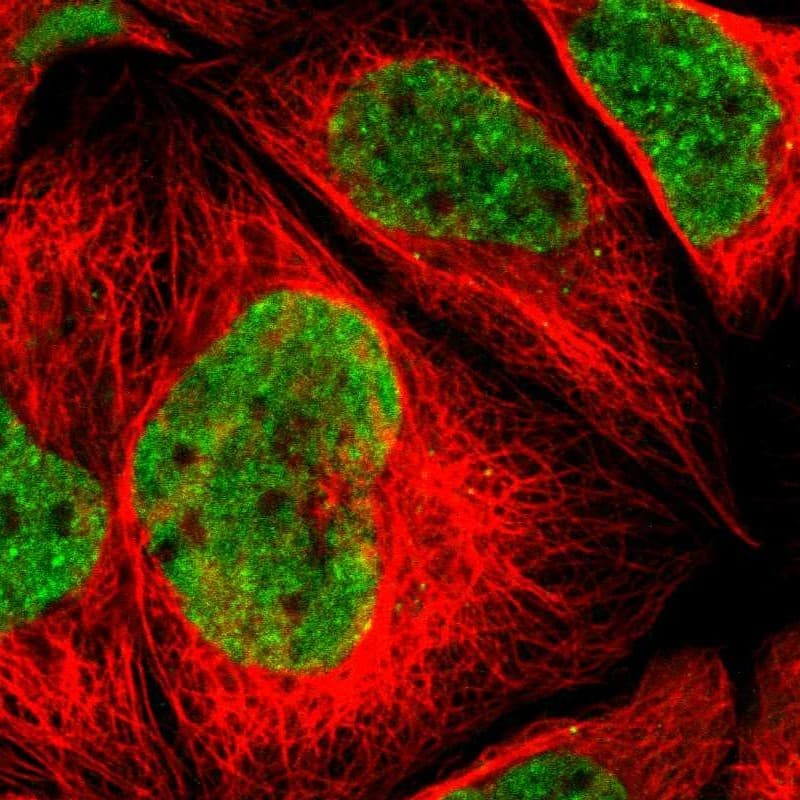 ZNF828 Antibody - BSA Free Immunocytochemistry/ Immunofluorescence: ZNF828 Antibody - BSA Free [NBP1-88403]
