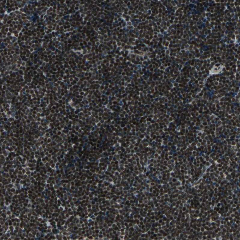 ZNF828 Antibody - BSA Free Immunohistochemistry-Paraffin: ZNF828 Antibody - BSA Free [NBP1-88403]