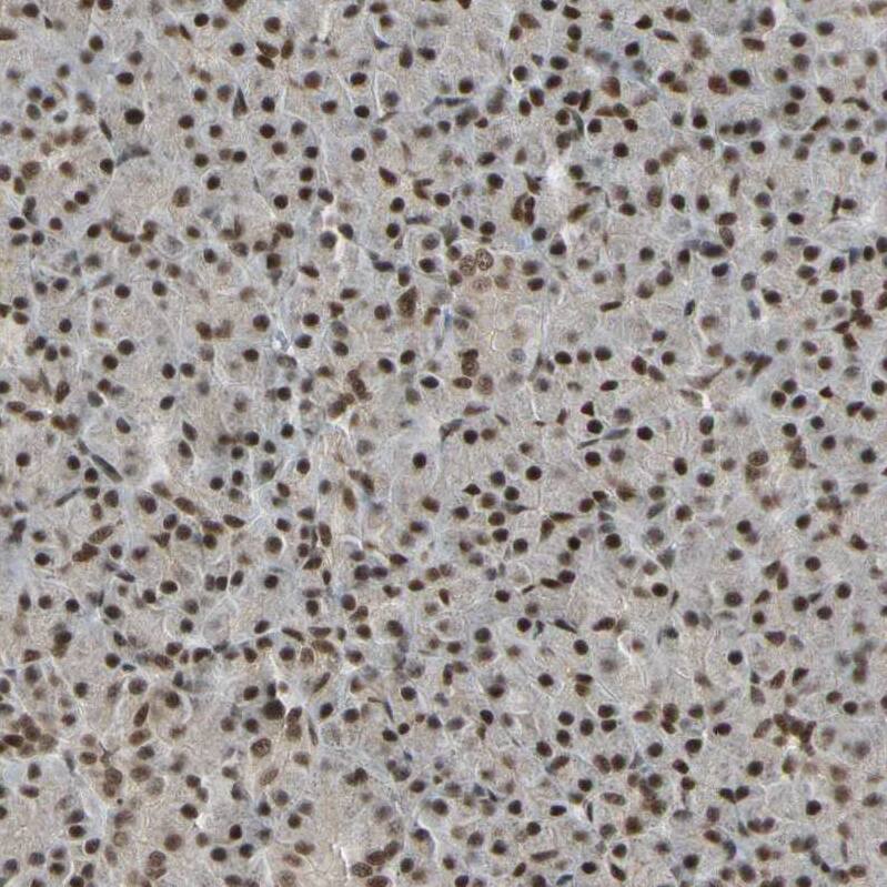 ZNF828 Antibody - BSA Free Immunohistochemistry-Paraffin: ZNF828 Antibody - BSA Free [NBP1-88403]