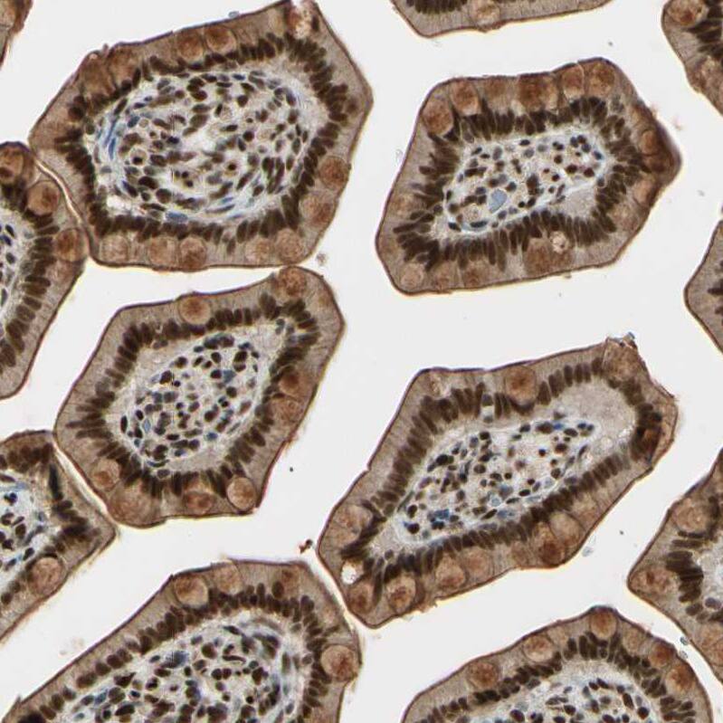 ZNF828 Antibody - BSA Free Immunohistochemistry-Paraffin: ZNF828 Antibody - BSA Free [NBP1-88403]