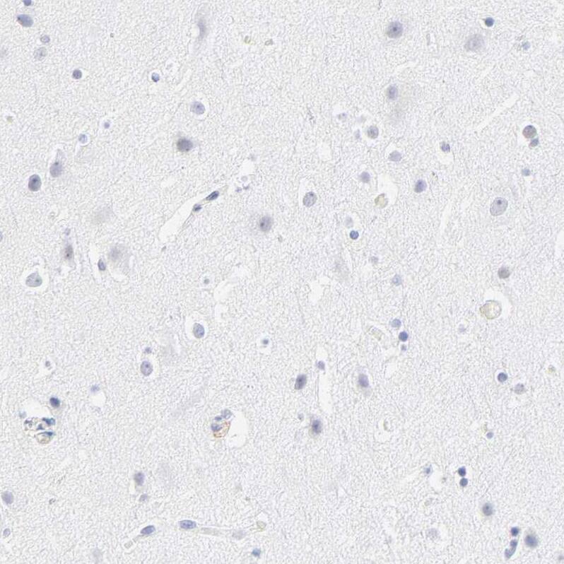 Latent TGF-beta bp2/LTBP-2 Antibody - BSA Free Immunohistochemistry-Paraffin: Latent TGF-beta bp2/LTBP-2 Antibody - BSA Free [NBP1-88411]