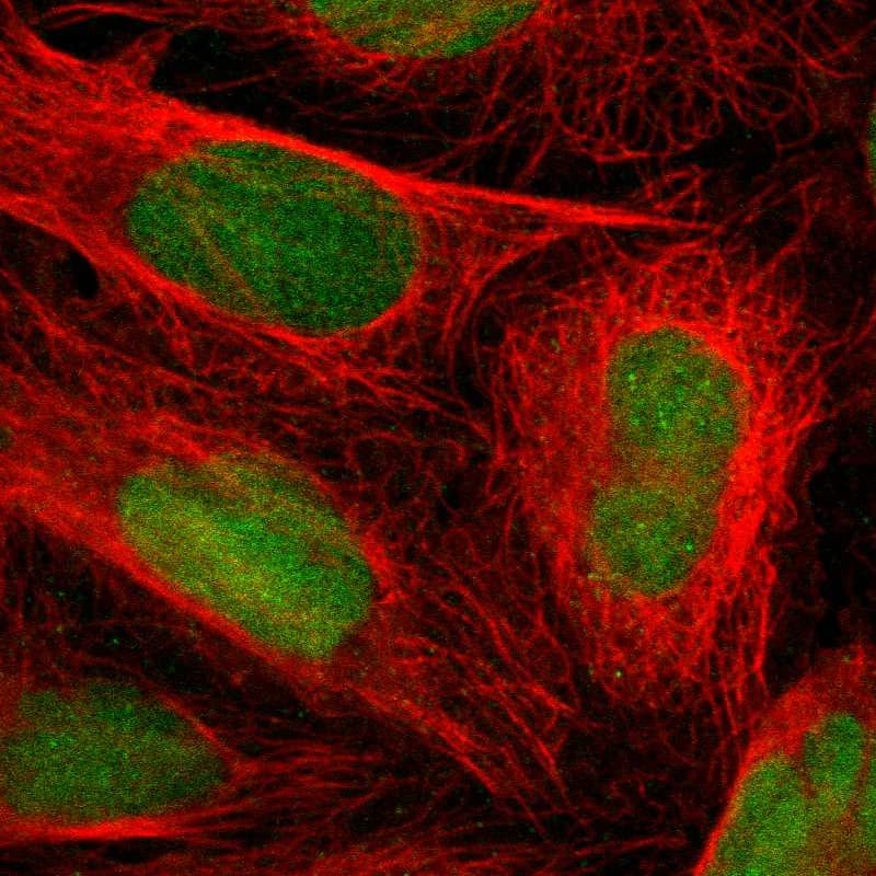 Latent TGF-beta bp2/LTBP-2 Antibody - BSA Free Immunocytochemistry/ Immunofluorescence: Latent TGF-beta bp2/LTBP-2 Antibody - BSA Free [NBP1-88411]