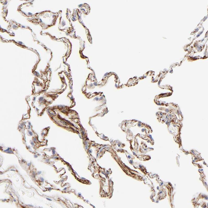 Latent TGF-beta bp2/LTBP-2 Antibody - BSA Free Immunohistochemistry-Paraffin: Latent TGF-beta bp2/LTBP-2 Antibody - BSA Free [NBP1-88411]