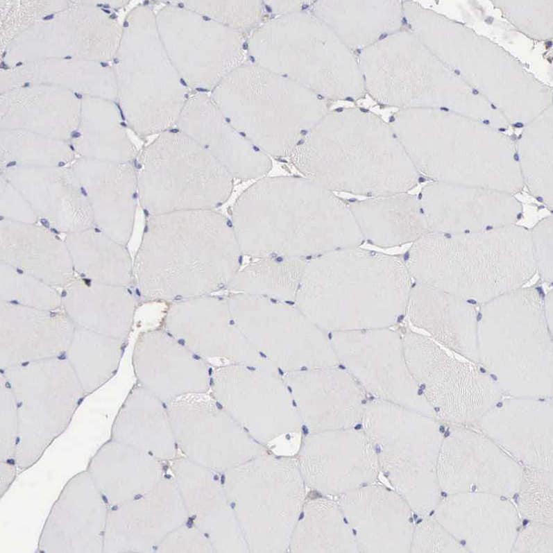 INF2 Antibody - BSA Free Immunohistochemistry-Paraffin: INF2 Antibody - BSA Free [NBP1-88414]