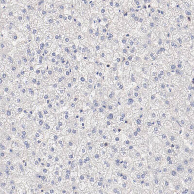 SETD3 Antibody - BSA Free Immunohistochemistry-Paraffin: SETD3 Antibody - BSA Free [NBP1-88415]
