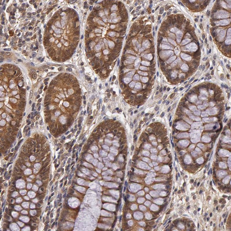 AHSA1 Antibody - BSA Free Immunohistochemistry-Paraffin: AHSA1 Antibody - BSA Free [NBP1-88419]