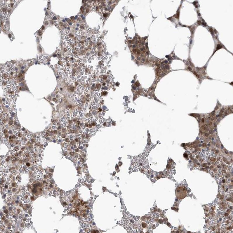 MAPK1IP1L Antibody - BSA Free Immunohistochemistry-Paraffin: MAPK1IP1L Antibody - BSA Free [NBP1-88420]