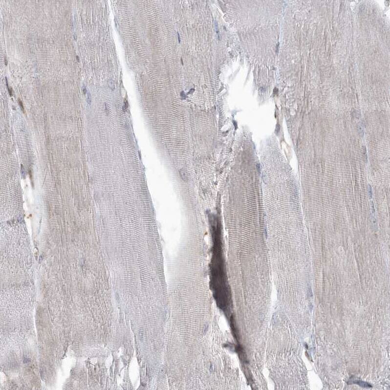 MAPK1IP1L Antibody - BSA Free Immunohistochemistry-Paraffin: MAPK1IP1L Antibody - BSA Free [NBP1-88420]