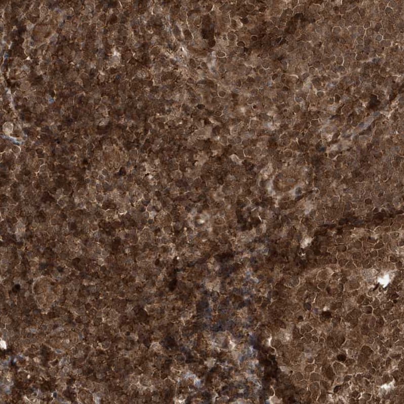 MAPK1IP1L Antibody - BSA Free Immunohistochemistry-Paraffin: MAPK1IP1L Antibody - BSA Free [NBP1-88420]