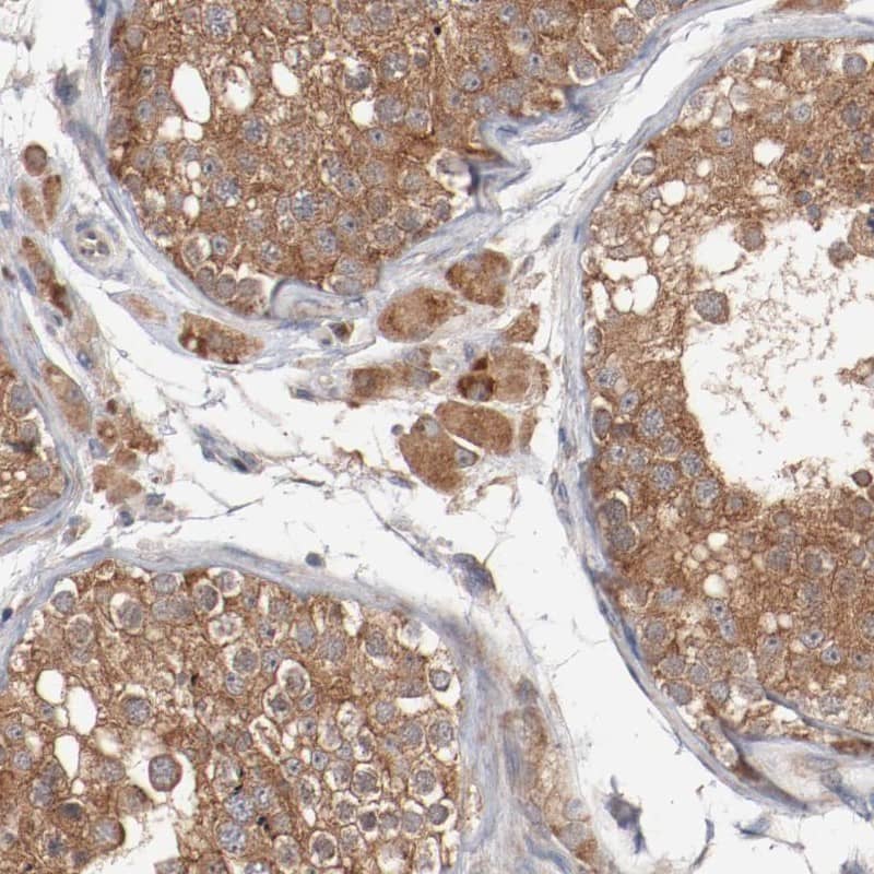 RNASE11 Antibody - BSA Free Immunohistochemistry-Paraffin: RNASE11 Antibody - BSA Free [NBP1-88423]