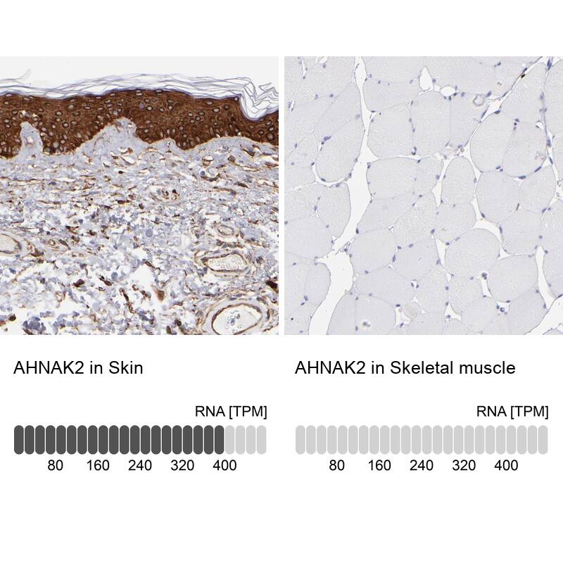 AHNAK2 Antibody - BSA Free Immunohistochemistry-Paraffin: AHNAK2 Antibody - BSA Free [NBP1-88428]