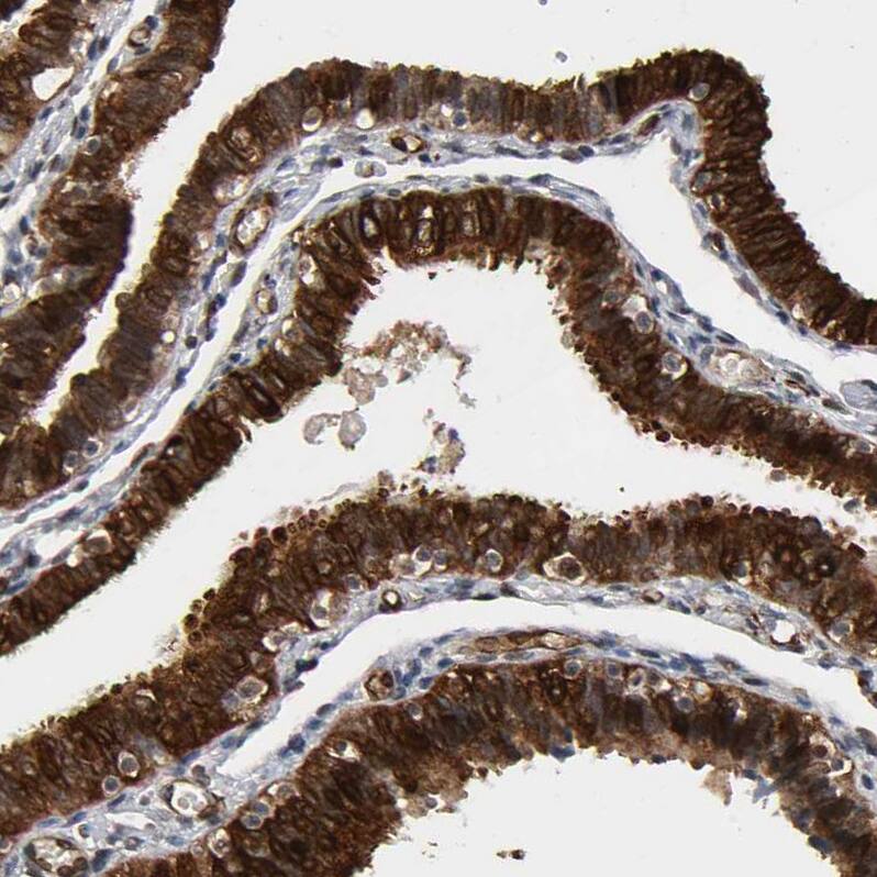 AHNAK2 Antibody - BSA Free Immunohistochemistry-Paraffin: AHNAK2 Antibody - BSA Free [NBP1-88429]