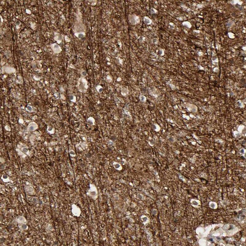 AHNAK2 Antibody - BSA Free Immunohistochemistry-Paraffin: AHNAK2 Antibody - BSA Free [NBP1-88429]