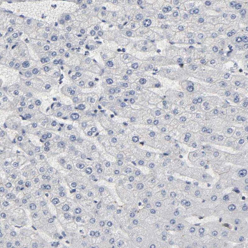 AHNAK2 Antibody - BSA Free Immunohistochemistry-Paraffin: AHNAK2 Antibody - BSA Free [NBP1-88429]
