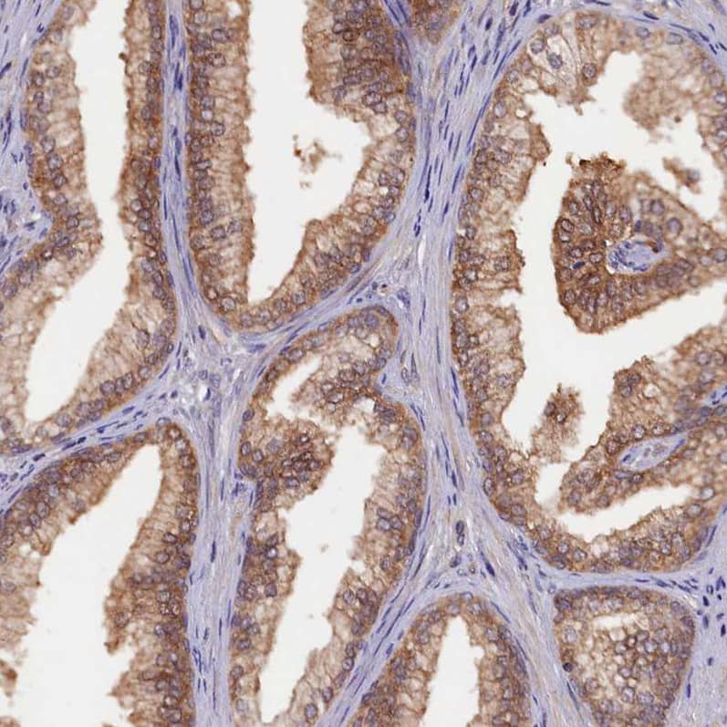 HN1L Antibody - BSA Free Immunohistochemistry-Paraffin: HN1L Antibody - BSA Free [NBP1-88445]