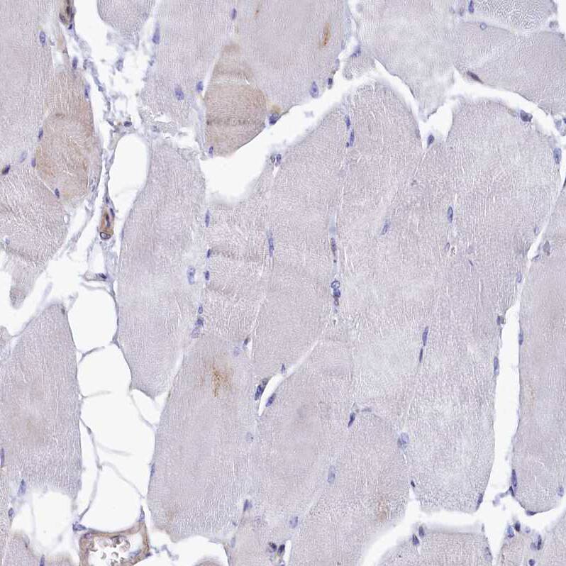 HN1L Antibody - BSA Free Immunohistochemistry-Paraffin: HN1L Antibody - BSA Free [NBP1-88445]