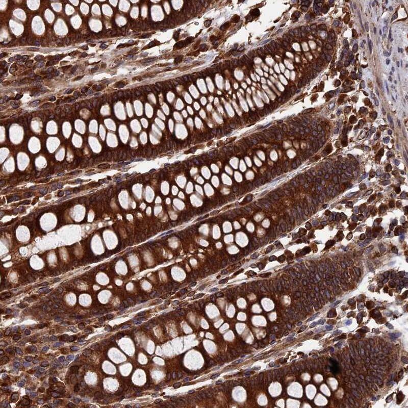 RPUSD1 Antibody - BSA Free Immunohistochemistry-Paraffin: RPUSD1 Antibody [NBP1-88448]