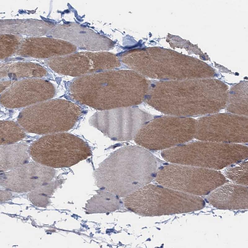 CTU2 Antibody - BSA Free Immunohistochemistry-Paraffin: CTU2 Antibody - BSA Free [NBP1-88457]