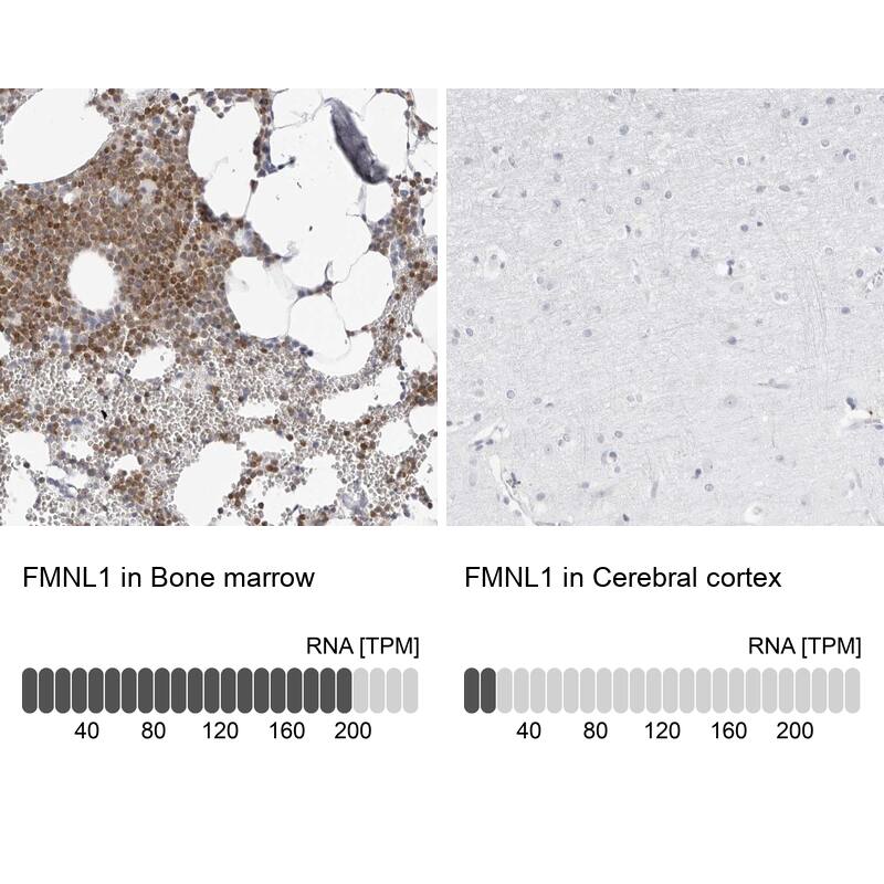 FMNL1 Antibody - BSA Free Immunohistochemistry-Paraffin: FMNL1 Antibody - BSA Free [NBP1-88461]