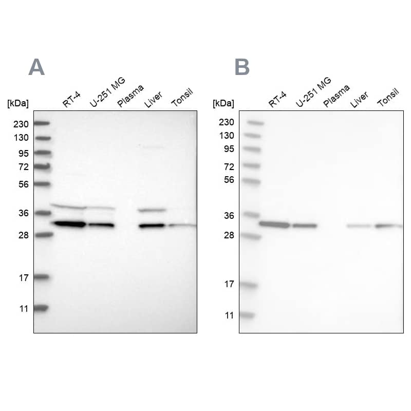 GLOD4 Antibody - BSA Free Western Blot: GLOD4 Antibody - BSA Free [NBP1-88464]