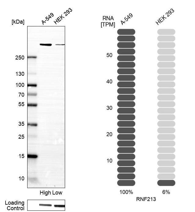 RNF213 Antibody - BSA Free Western Blot: RNF213 Antibody - BSA Free [NBP1-88465]