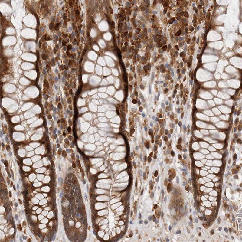 RNF213 Antibody - BSA Free Immunohistochemistry-Paraffin: RNF213 Antibody - BSA Free [NBP1-88465]