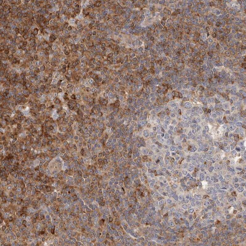 RNF213 Antibody - BSA Free Immunohistochemistry-Paraffin: RNF213 Antibody - BSA Free [NBP1-88465]