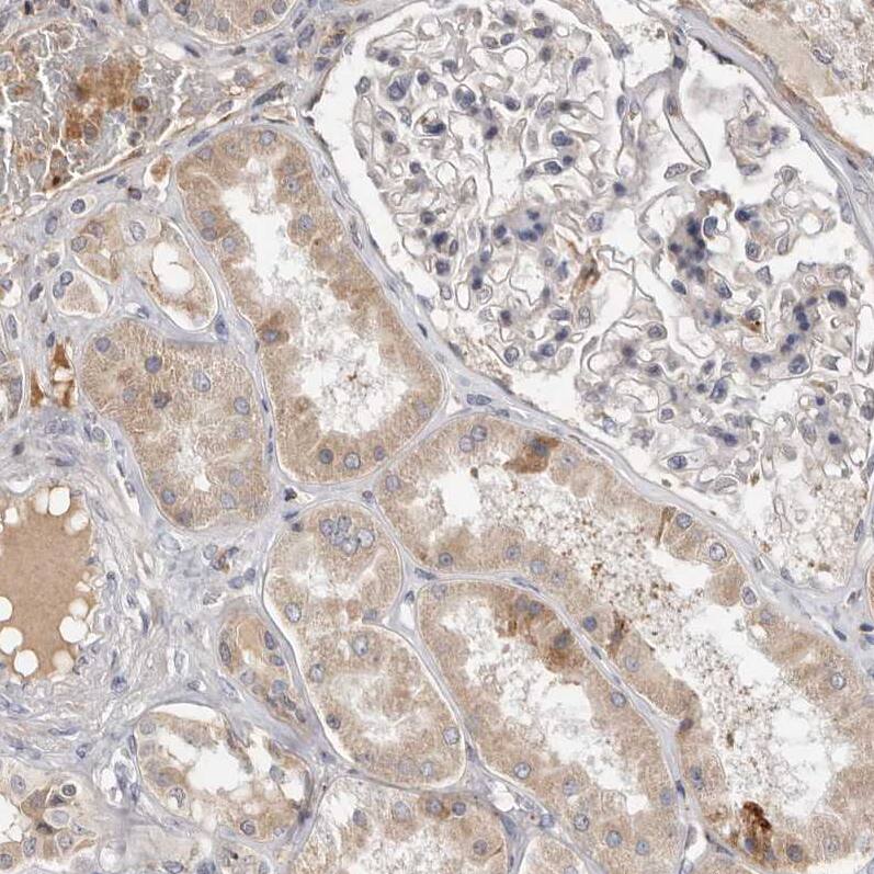 RNF213 Antibody - BSA Free Immunohistochemistry-Paraffin: RNF213 Antibody - BSA Free [NBP1-88465]