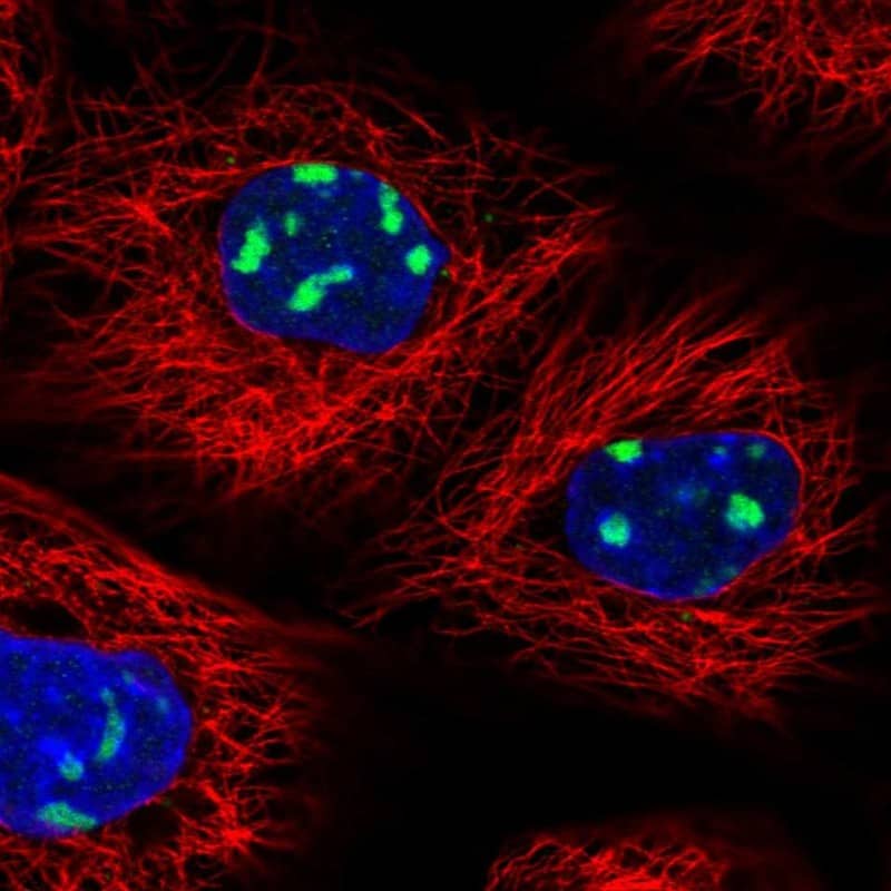 UTP6 Antibody - BSA Free Immunocytochemistry/ Immunofluorescence: UTP6 Antibody [NBP1-88468]