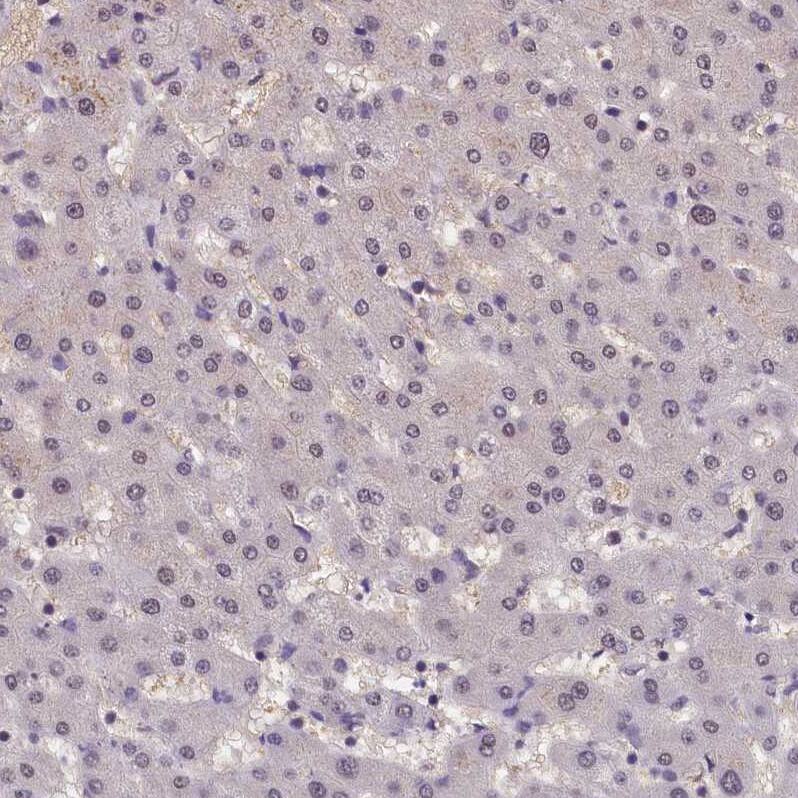 ZC3H4 Antibody - BSA Free Immunohistochemistry-Paraffin: ZC3H4 Antibody - BSA Free [NBP1-88475]