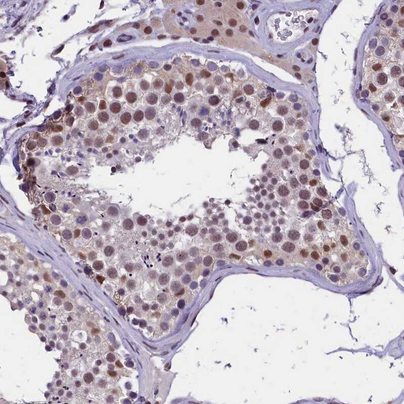 ZC3H4 Antibody - BSA Free Immunohistochemistry-Paraffin: ZC3H4 Antibody - BSA Free [NBP1-88475]