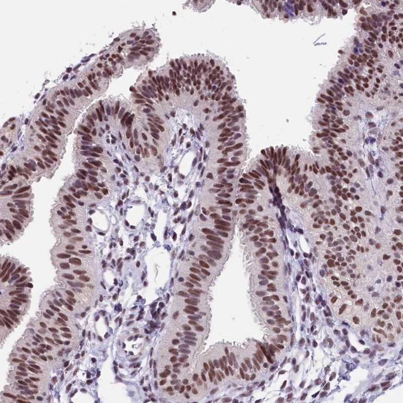 ZC3H4 Antibody - BSA Free Immunohistochemistry-Paraffin: ZC3H4 Antibody - BSA Free [NBP1-88475]