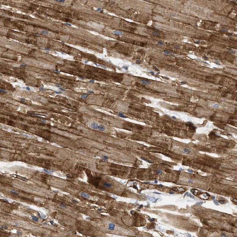 PALMD Antibody - BSA Free Immunohistochemistry-Paraffin: PALMD Antibody - BSA Free [NBP1-88481]