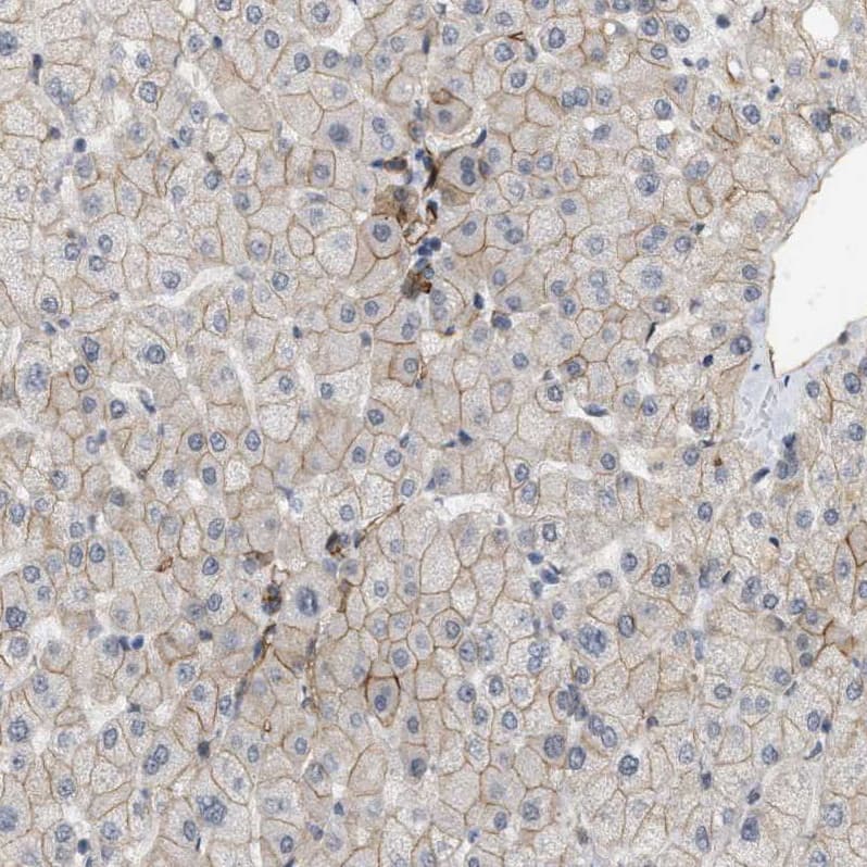 PALMD Antibody - BSA Free Immunohistochemistry-Paraffin: PALMD Antibody - BSA Free [NBP1-88481]